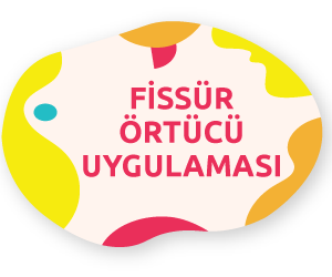 FİSSÜR ÖRTÜCÜ UYGULAMALARI